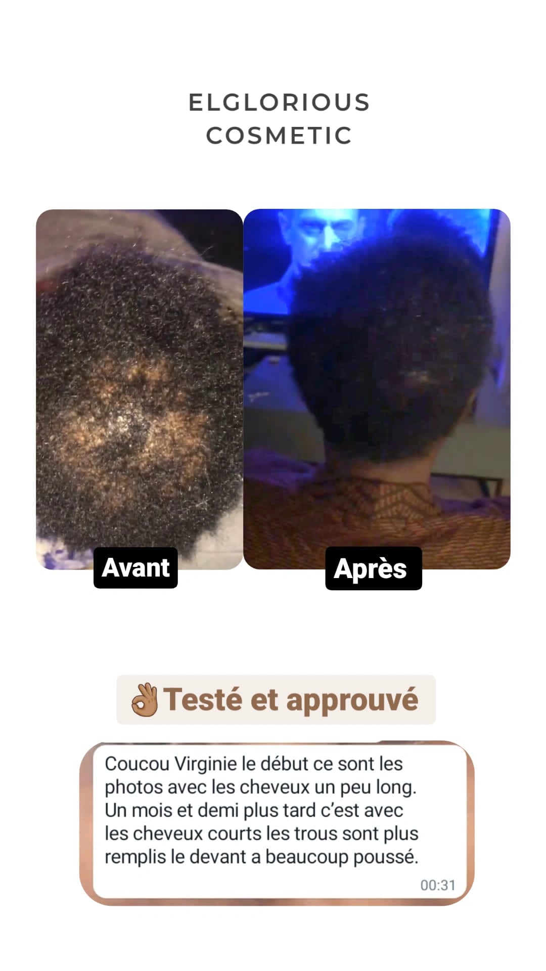 Crème spéciale pousse 30 ml - Solution Alopécie