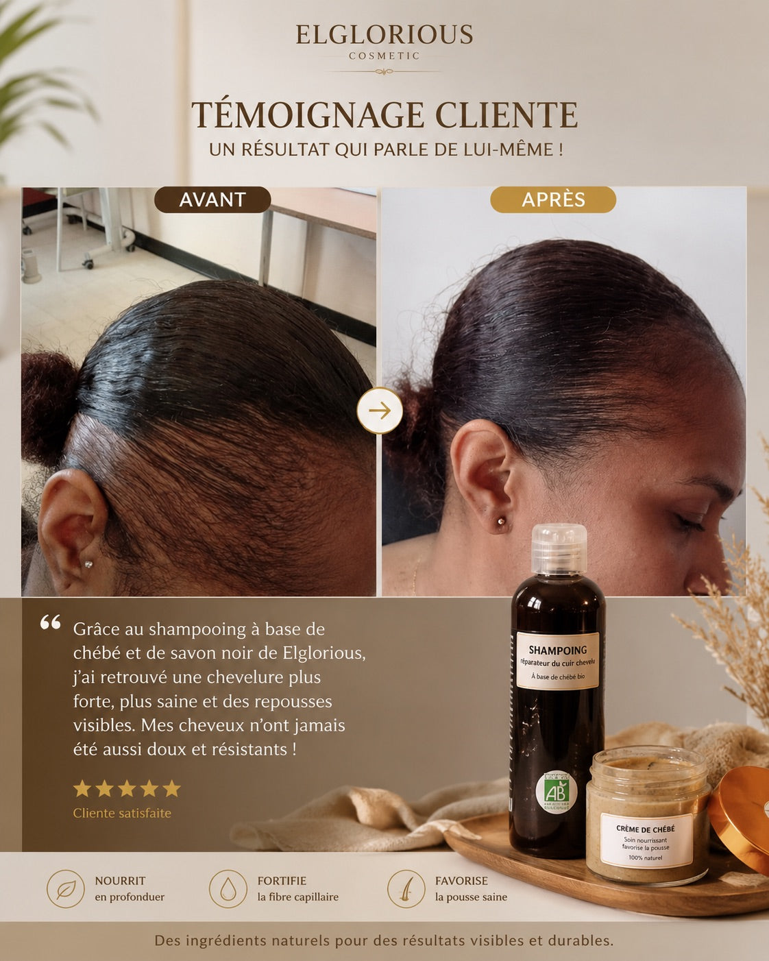 Crème spéciale pousse 30 ml - Solution Alopécie