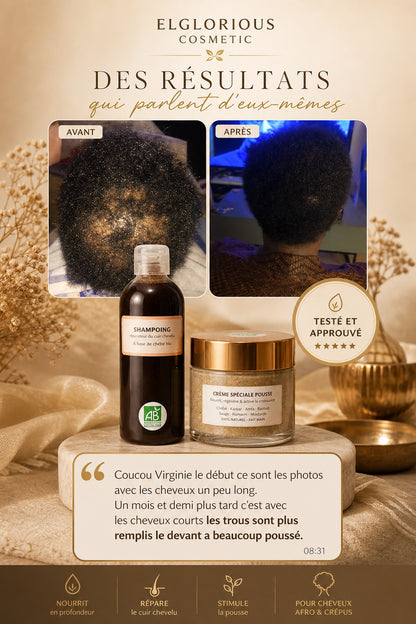 Crème spéciale pousse 30 ml - Solution Alopécie